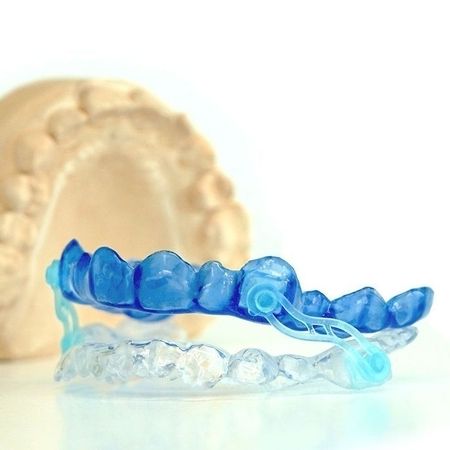 Blue and transparent dental splints on a model of a jaw.